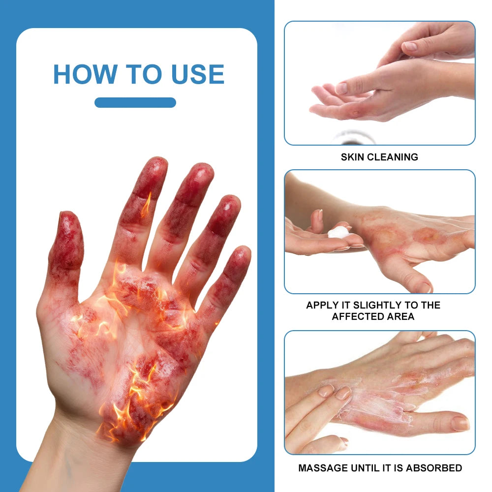 Crème Cicatrisante Sumifun – Réparation Rapide des Plaies