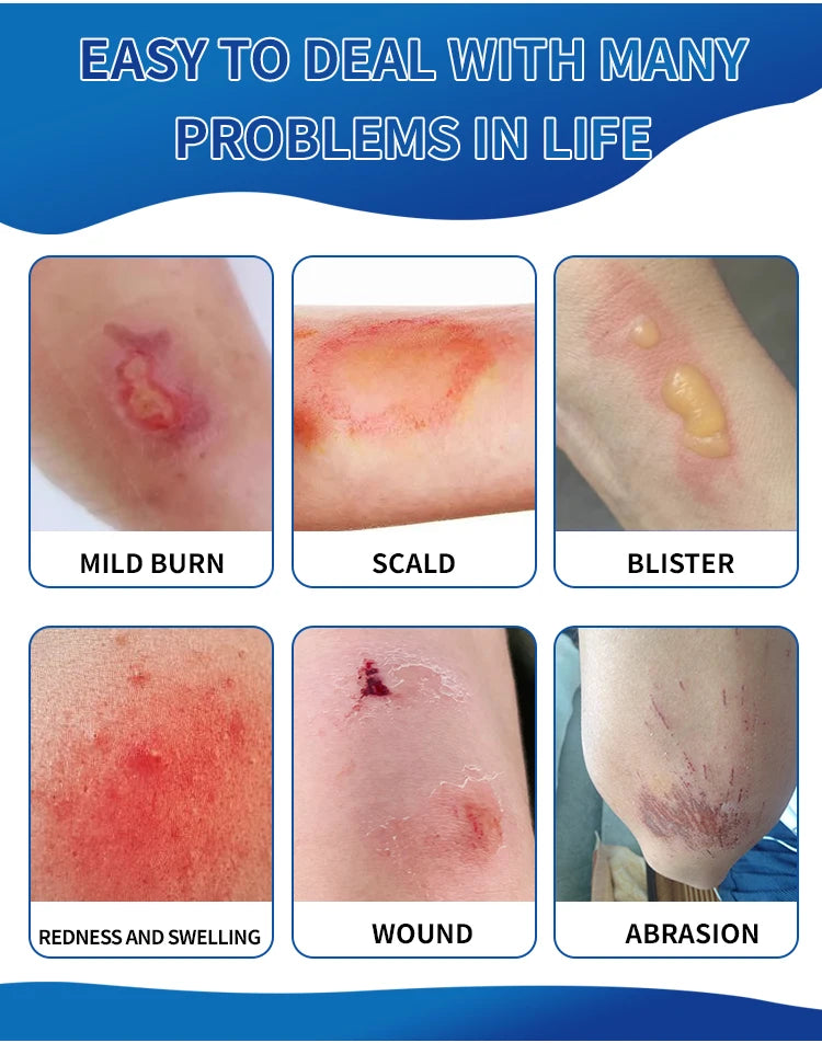 Crème Cicatrisante Sumifun – Réparation Rapide des Plaies