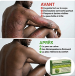 Charger l'image dans la galerie, Savon Antifongique __ Pour les démangeaisons sur les zone sensibles - Bien-être hommes et femmes (Copie)

