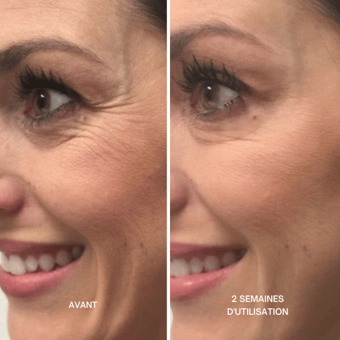 Crème Lifting Instantané - Effet Anti-Poches & Anti-Rides en 5 Minutes