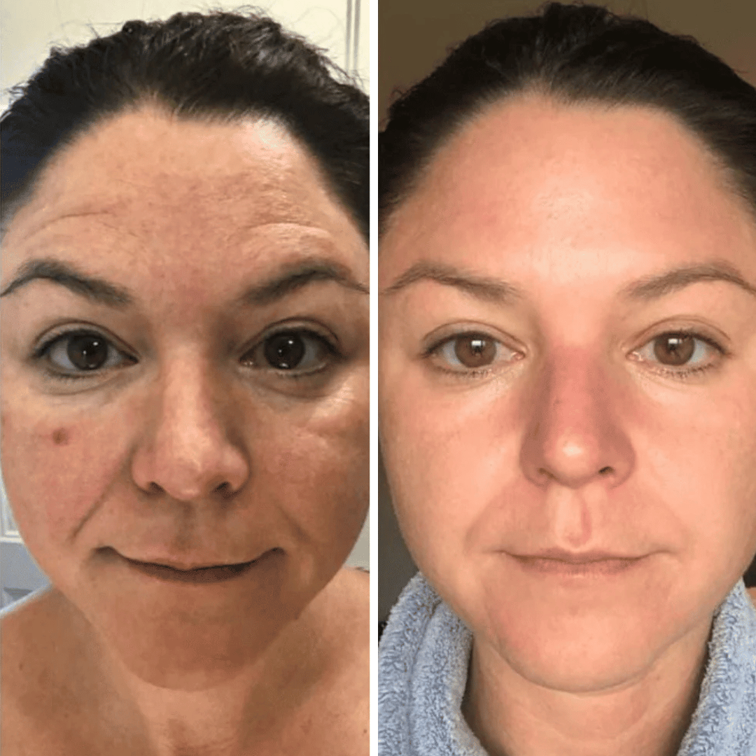 Crème Lifting Instantané - Effet Anti-Poches & Anti-Rides en 5 Minutes