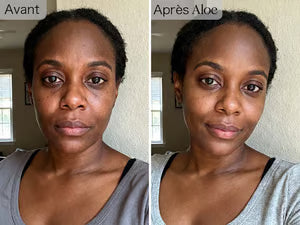 Patchs Hydrogel à l'Aloe Vera, Lutte Contre les Cernes et Rides autour des Yeux