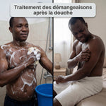 Charger l'image dans la galerie, Savon Bio Antifongique __ Efficace contre les infections cutanées

